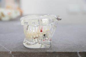 Endodoncia