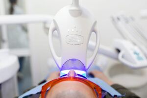 Estética dental
