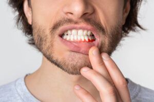 Periodoncia