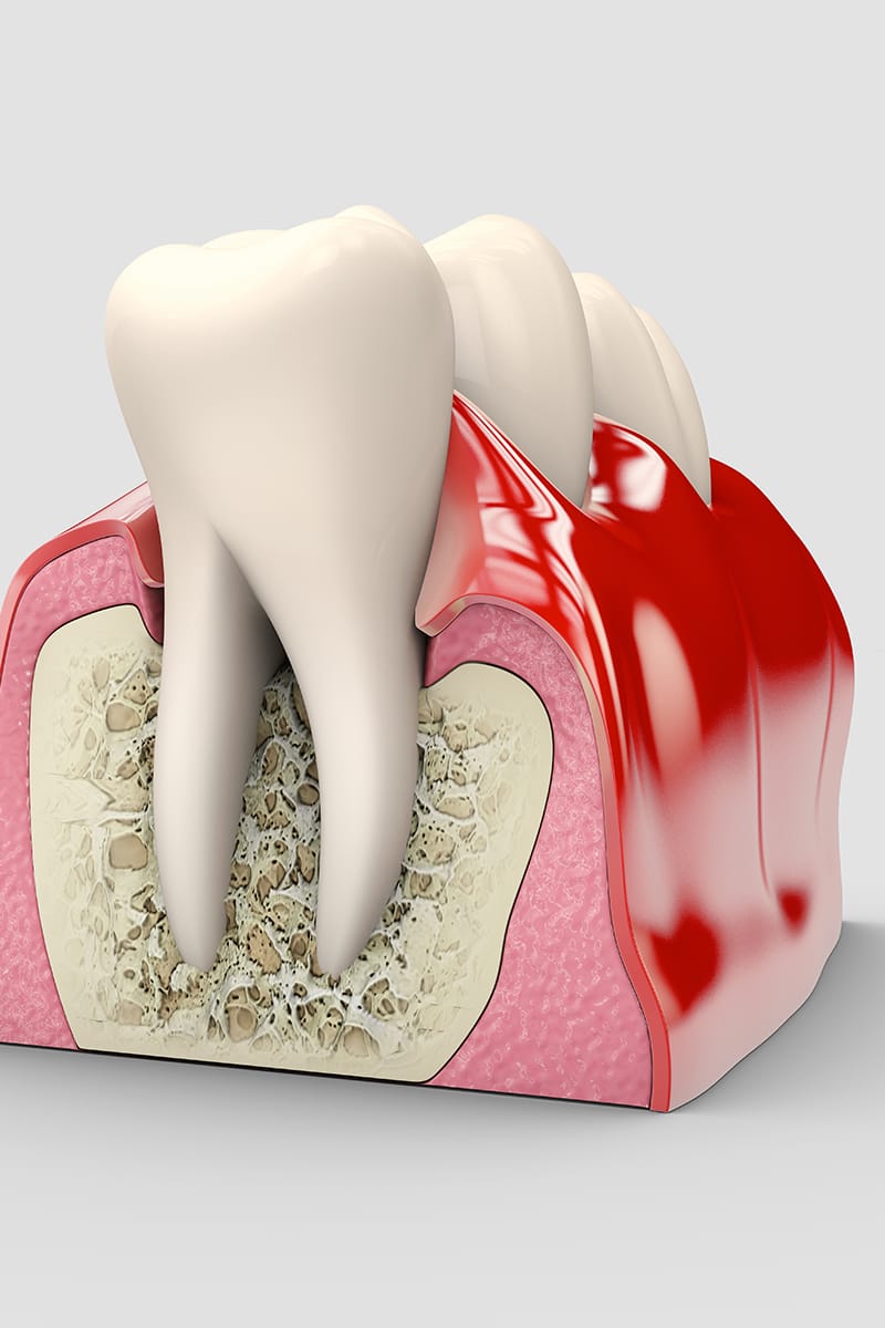 Cdsm Tratamientos Periodoncia Main